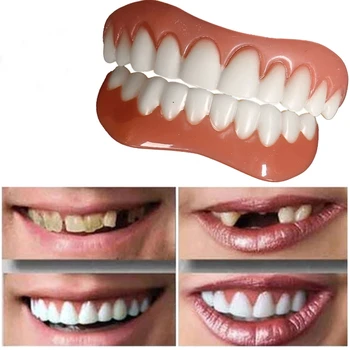 Protézy horných a dolných dyhy dokonalý úsmev dyha Protézy vložiť protézy traky pohodlné orthodontics